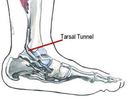 Tarsal Region